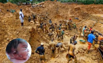 ‘Doctor, was it something I did?’ – Galamsey causing deformities in babies
